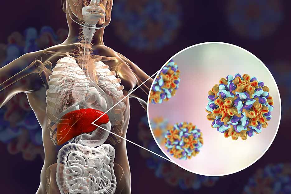 What Is Viral Hepatitis Vietnam Viral Hepatitis Alliance